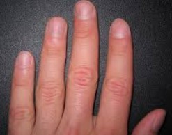 По состоянию ногтей можно диагностировать болезни