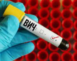 Российские ученые изобрели новый способ лечения ВИЧ Российские ученые изобрели новый способ лечения ВИЧ